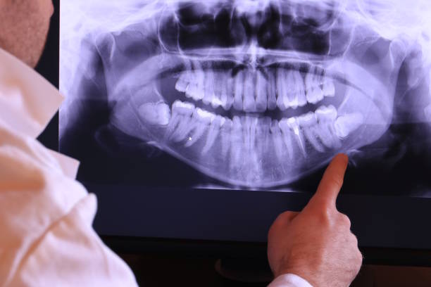 Best Urgent Care for Lost Fillings or Crowns in Richwood, TX